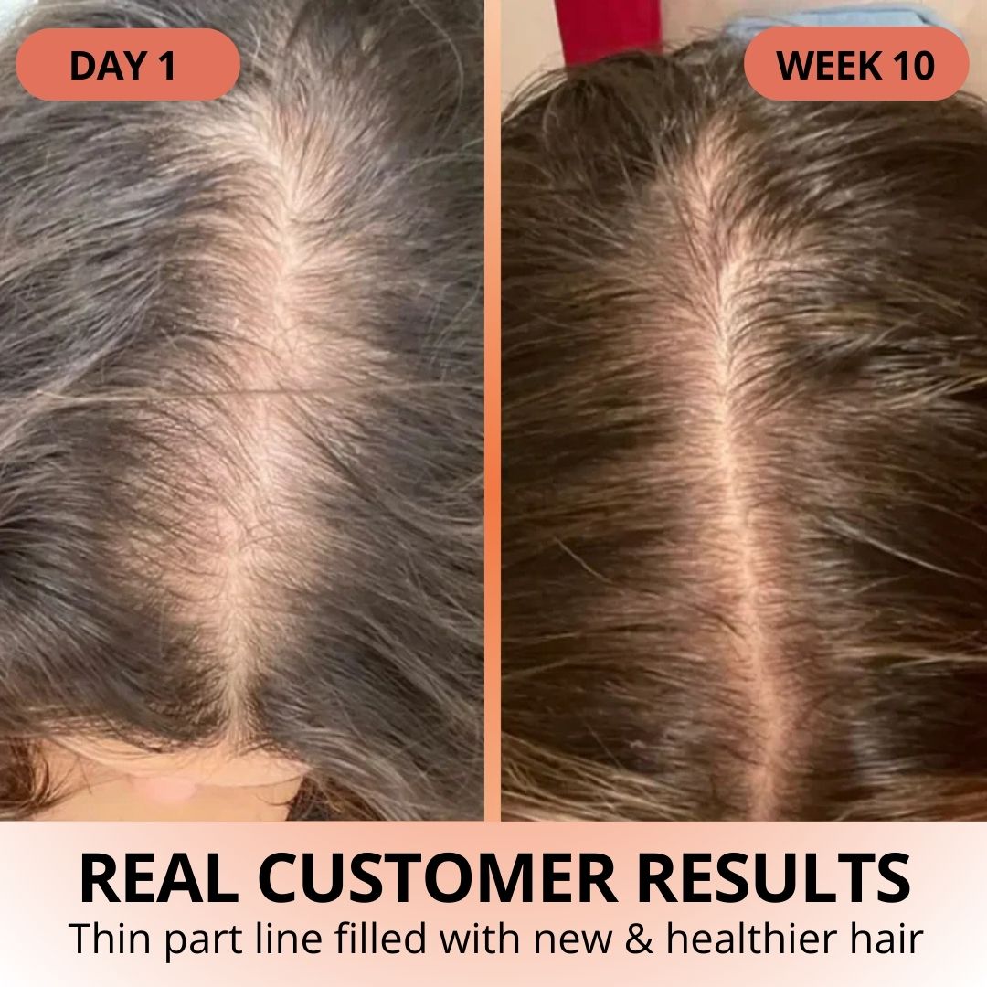 Pumpkin Seed Oil Softgels