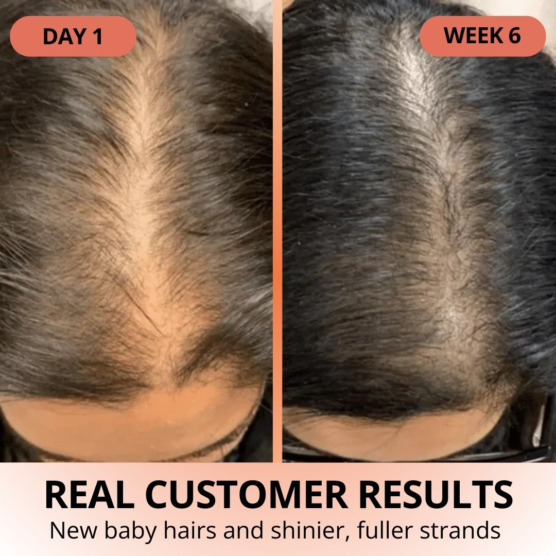 Pumpkin Seed Oil Softgels