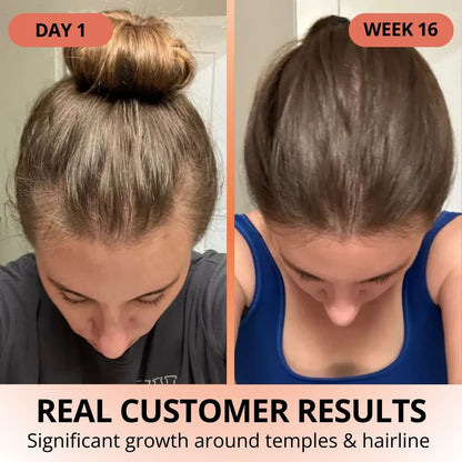 Pumpkin Seed Oil Softgels