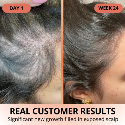 Pumpkin Seed Oil Softgels